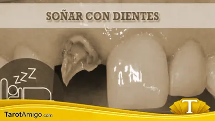 Dientes Rotos
